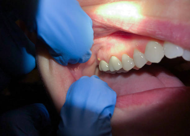 Best Emergency Gum Pain Relief  in Smith Valley, NV