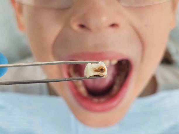 Urgent Tooth Repair in NV