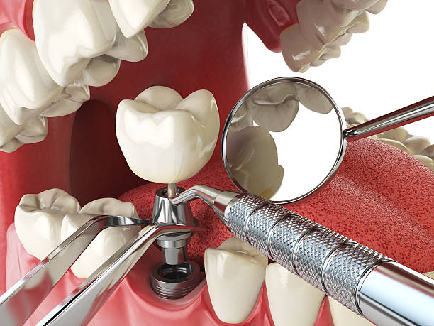Best Knocked-Out Tooth Emergency  in Smith Valley, NV