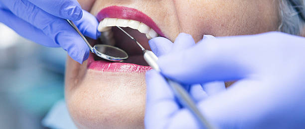 Emergency Dental Filling Replacement in NV